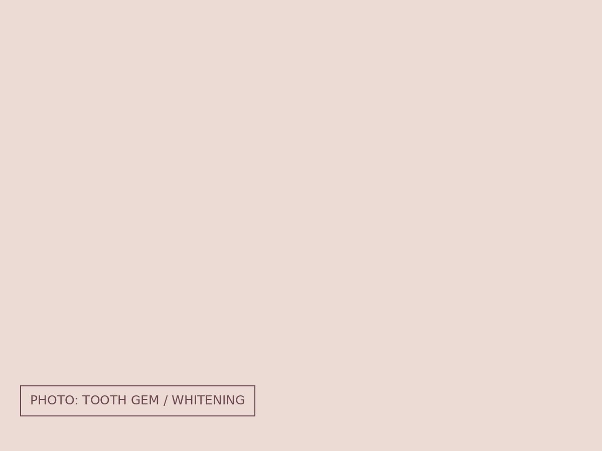 Tooth gem and teeth whitening